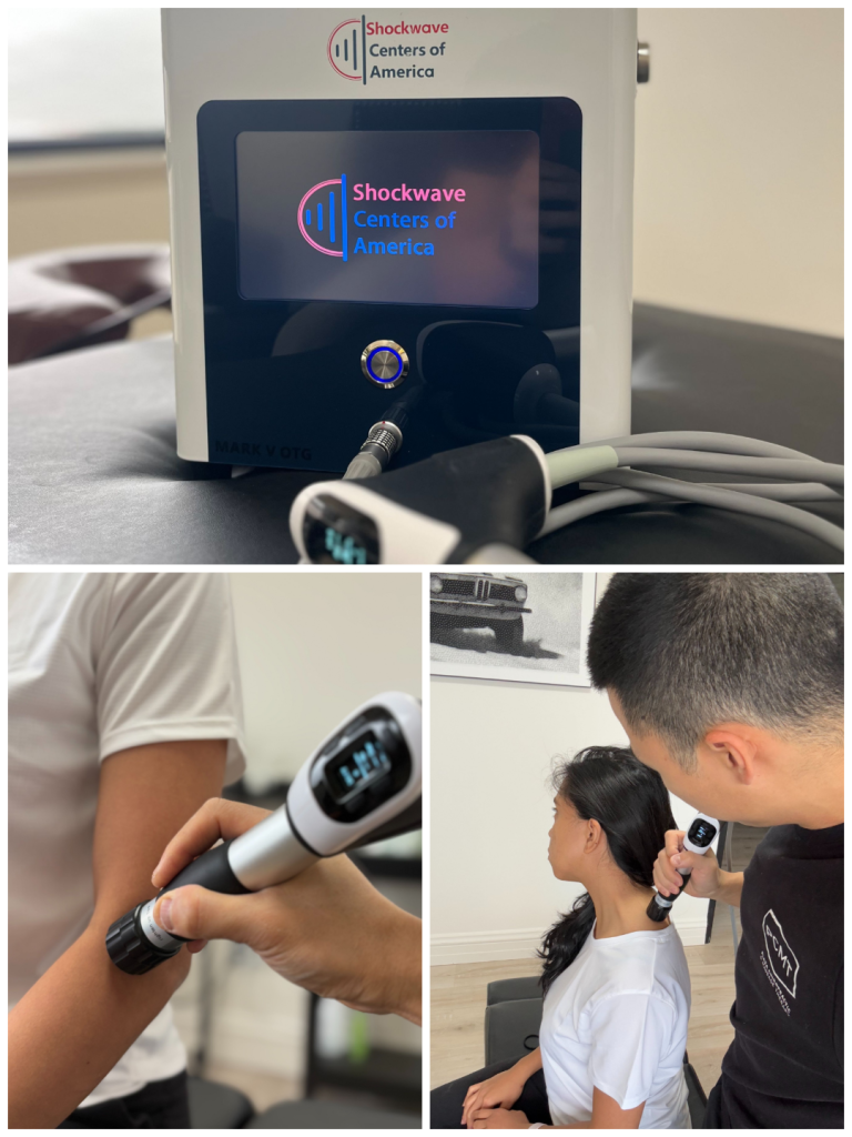 Introducing Shockwave Therapy